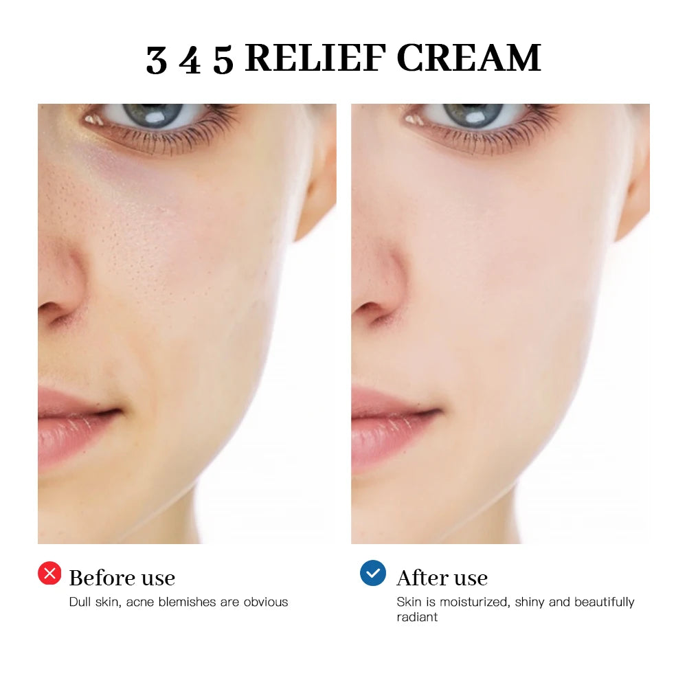 345 Relief Cream – Brightening, Anti-Acne Marks, Anti-Oxidant & Moisturizing Skincare